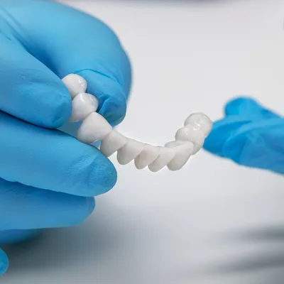 rehabilitacion dental protesis dental