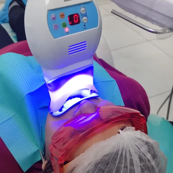blanqueamiento dental precio