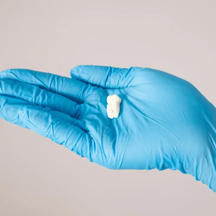 extracciones dentales y cirugia de muelas de juicio