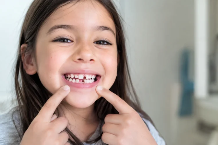 sonrisa infantil con dientes de leche cuando caen los dientes en niños